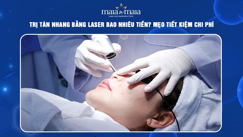 trị tàn nhang bằng laser bao nhiêu tiền