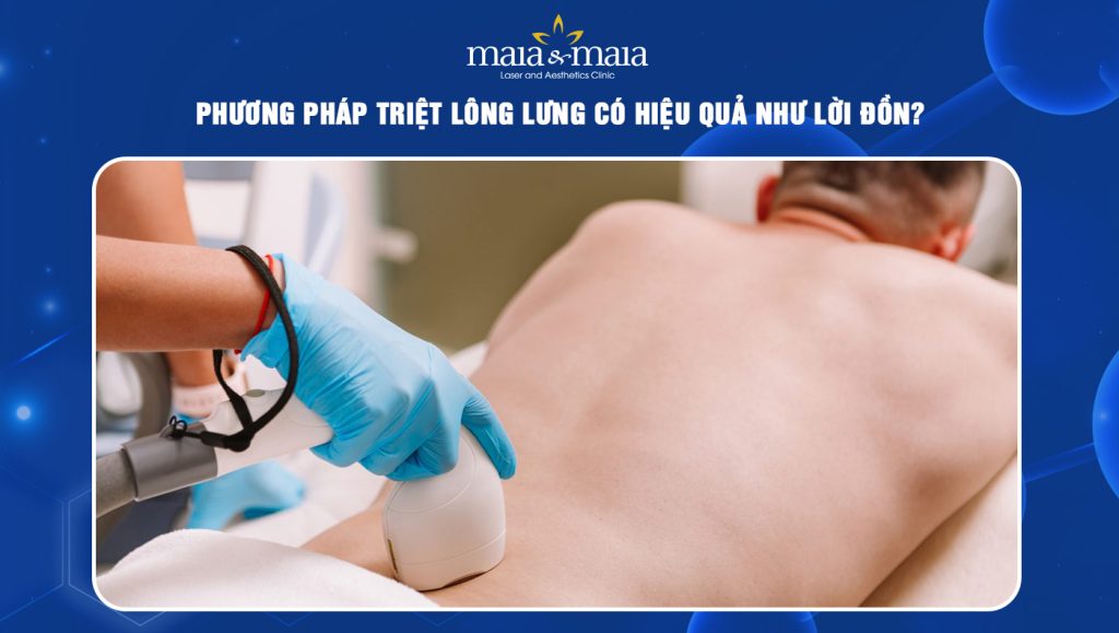 triệt lông lưng