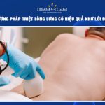 triệt lông lưng