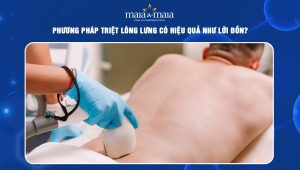 Phương pháp triệt lông lưng có hiệu quả như lời đồn? 84 triệt lông lưng