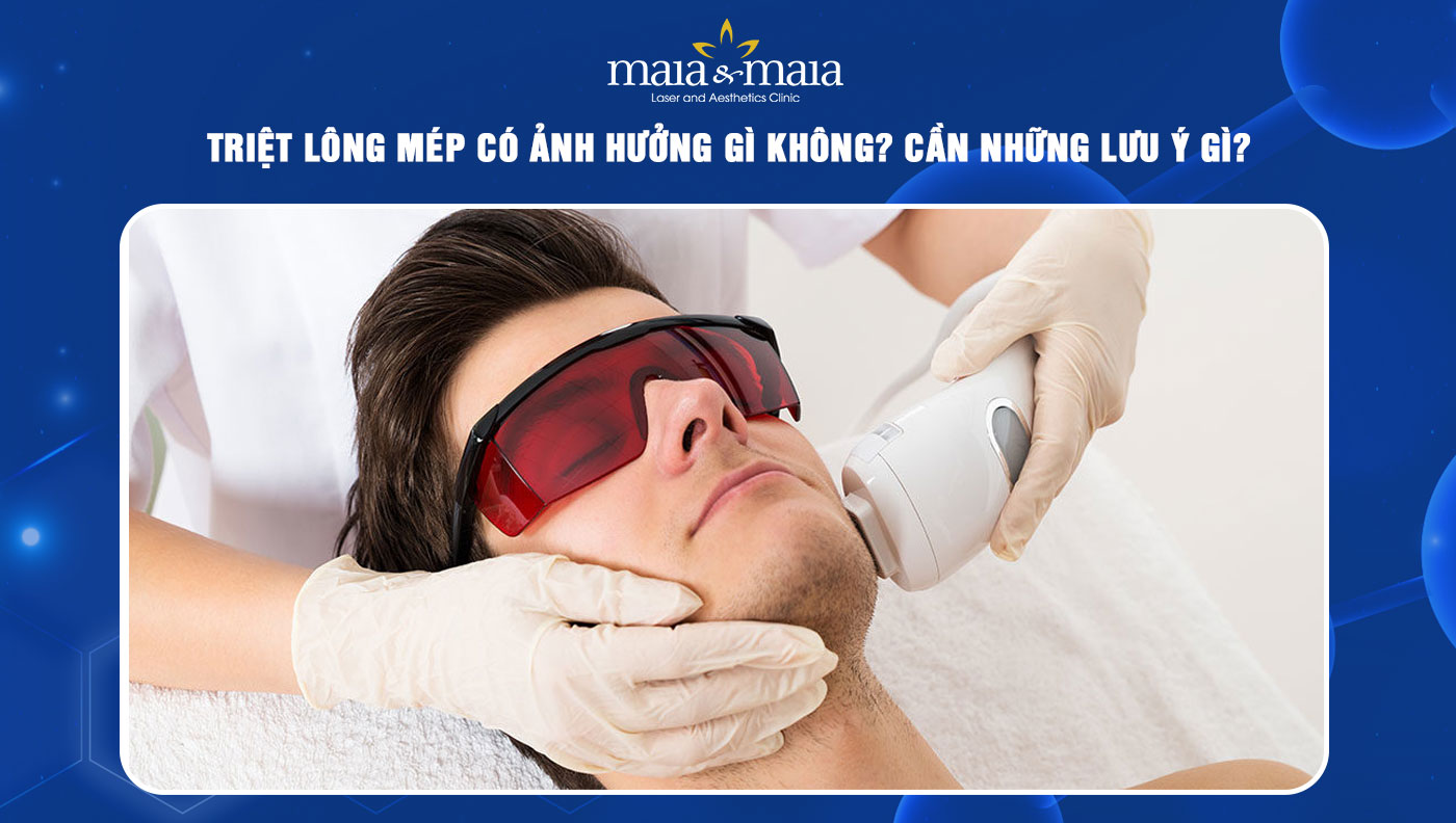 Triệt lông mép có ảnh hưởng gì không? Cần những lưu ý gì?  1 triệt lông mép có ảnh hưởng gì không