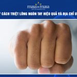triệt lông ngón tay