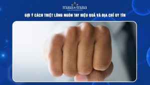 Gợi ý cách triệt lông ngón tay hiệu quả và địa chỉ uy tín  79 triệt lông ngón tay