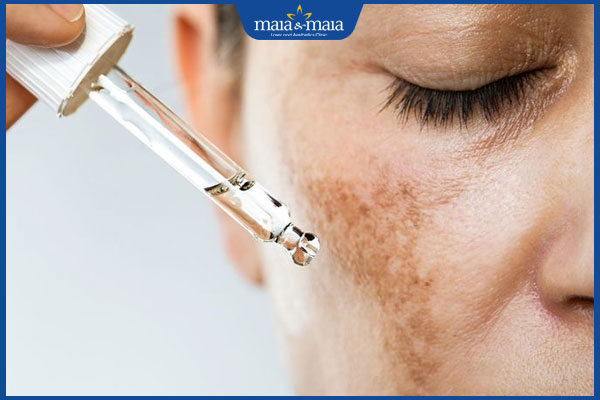 công dụng trị nám của retinol