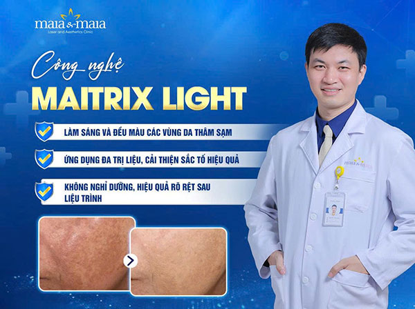 Đốm đen trên da: Nguyên nhân, chẩn đoán và cách cải thiện 5 công nghệ maitrix light