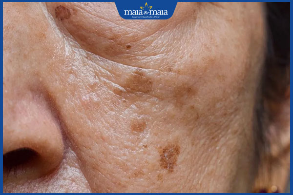 đặc điểm đồi mồi