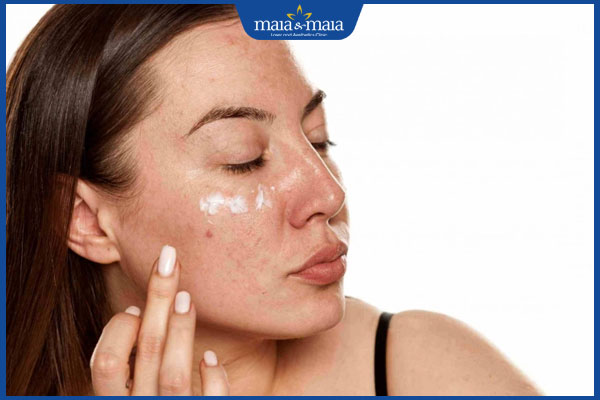 đồi mồi mờ đi sau sinh