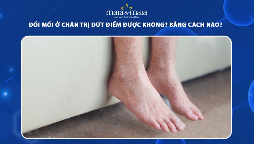 Bác sĩ giải đáp: Đồi mồi ở chân có xóa bỏ dứt điểm được không? 1 đồi mồi ở chân