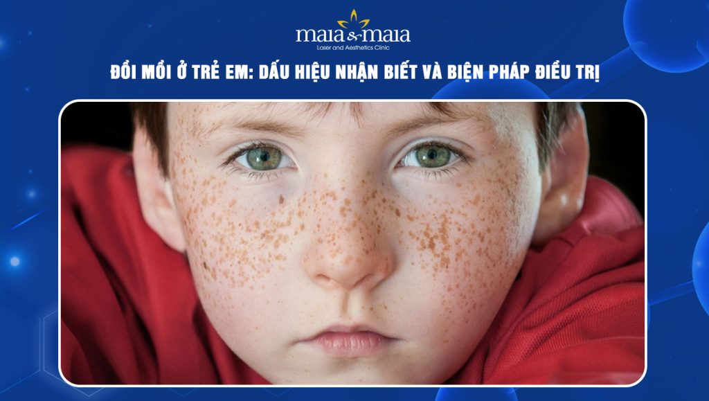 đồi mồi ở trẻ em