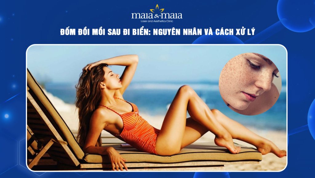 Đốm đồi mồi sau đi biển: Nguyên nhân và cách xử lý 1 đốm đồi mồi sau đi biển