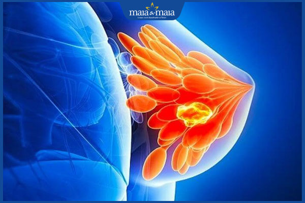 Nhũ hoa có đốm trắng khi mang thai: Nguyên nhân và cách chăm sóc 3 nang tuyến vú