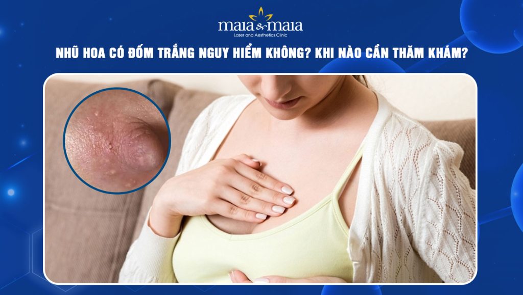 nhũ hoa có đốm trắng