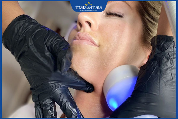 Đồi mồi ở cổ xuất hiện do đâu? Phương pháp điều trị hiệu quả 5 phương pháp áp lạnh