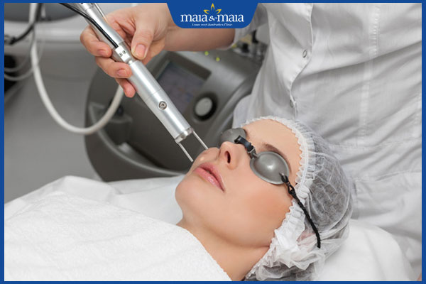 Bắn tàn nhang có tốt không? Quy trình và chi phí thực hiện 2 phương pháp bắn tàn nhang