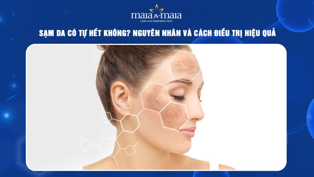 sạm da