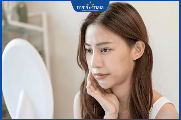 Sạm da khi mang thai: Nguyên nhân và cách cải thiện tại nhà 3 sạm da có thể hết sau sinh