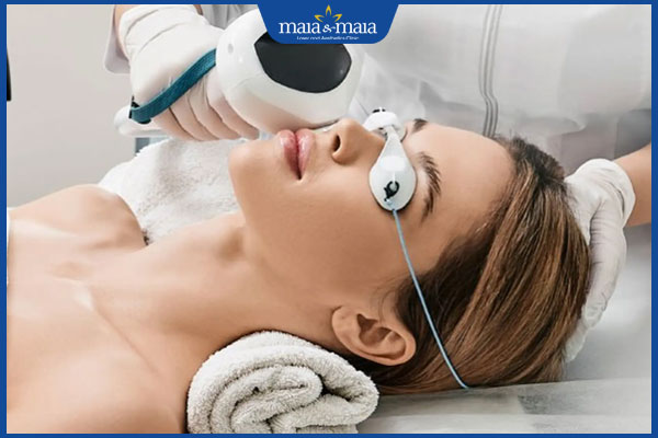 Đồi mồi có tự hết không? Gợi ý giải pháp làm mờ vết đồi mồi 3 sử dụng công nghệ cao xóa đồi mồi