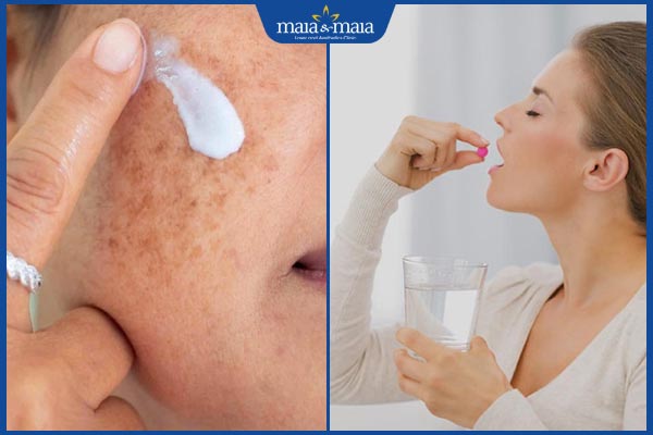 Dùng thuốc trị nám da có tốt không? Những lưu ý an toàn 2 thuốc trị nám