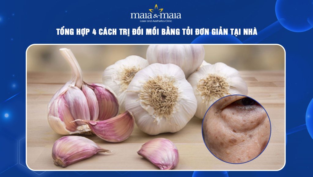 trị đồi mồi bằng tỏi