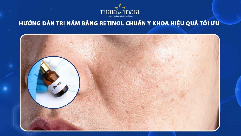 trị nám bằng retinol