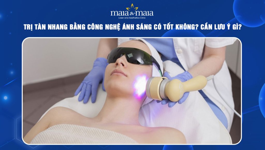 trị tàn nhang bằng công nghệ ánh sáng