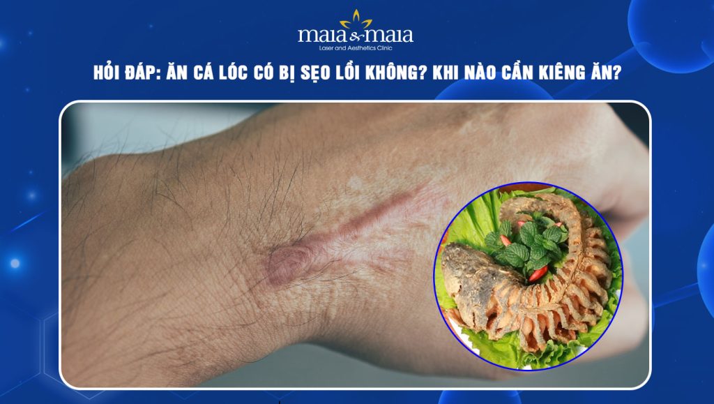 ăn cá lóc có bị sẹo lồi không