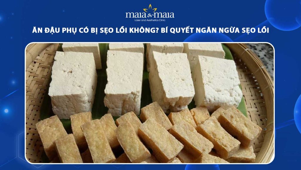 Ăn đậu phụ có bị sẹo lồi không? Bí quyết ngăn ngừa sẹo lồi 1 ăn đậu phụ có bị sẹo lồi không