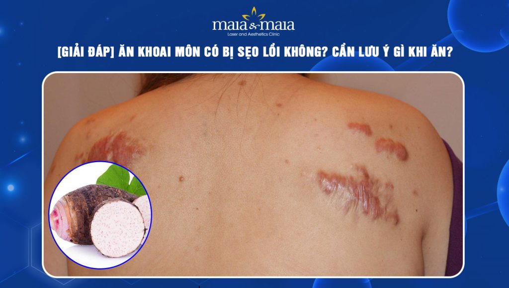 ăn khoai môn có bị sẹo lồi không