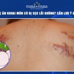 ăn khoai môn có bị sẹo lồi không