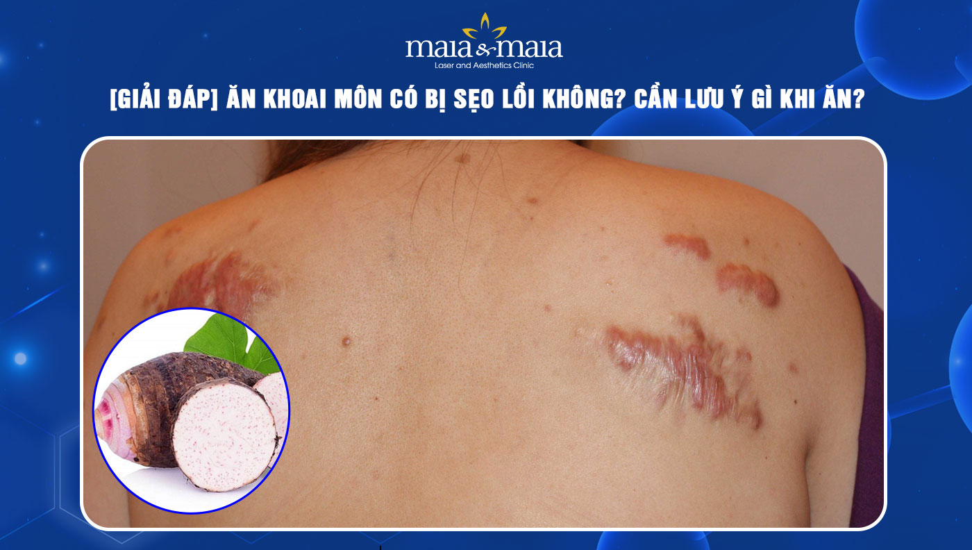 ăn khoai môn có bị sẹo lồi không
