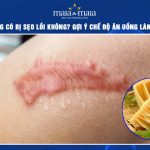 ăn măng có bị sẹo lồi không