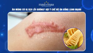 ăn măng có bị sẹo lồi không