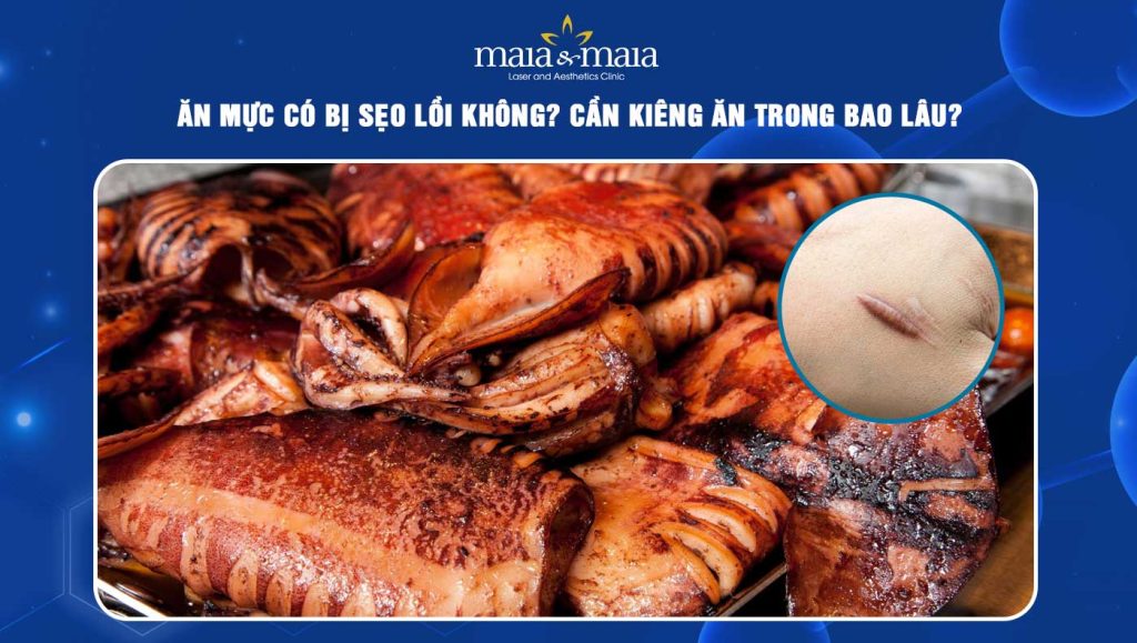 ăn mực có bị sẹo lồi không