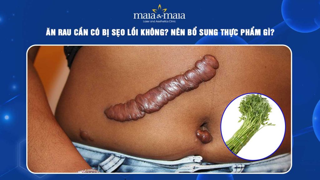 Ăn rau cần có bị sẹo lồi không? Nên bổ sung thực phẩm gì? 1 ăn rau cần có bị sẹo lồi không