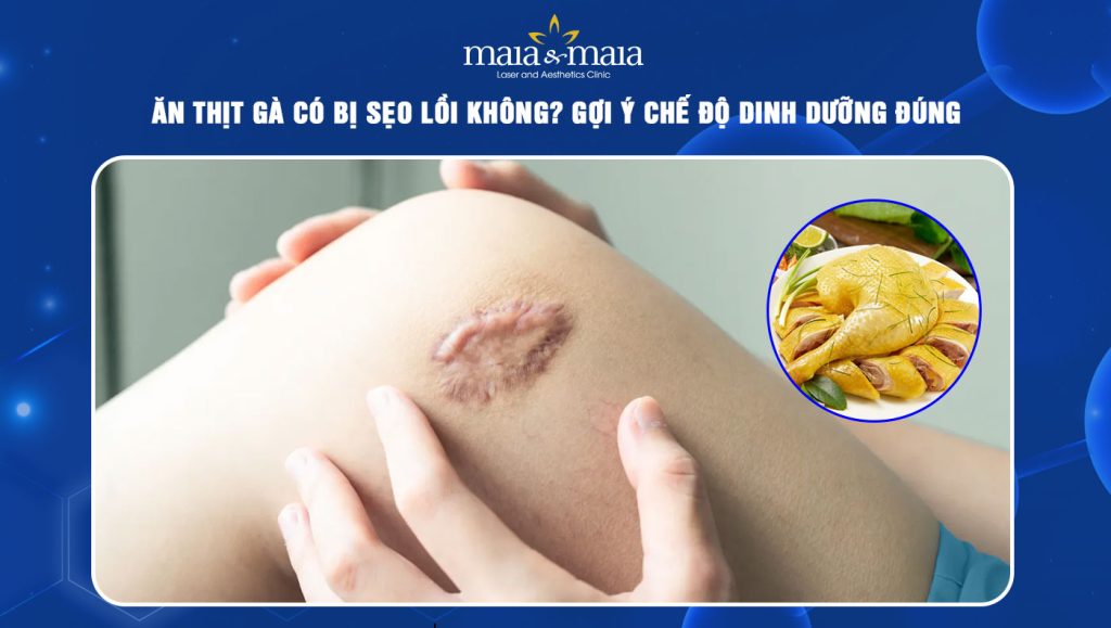Ăn thịt gà có bị sẹo lồi không? Chế độ dinh dưỡng lý tưởng 1 ăn thịt gà có bị sẹo lồi không