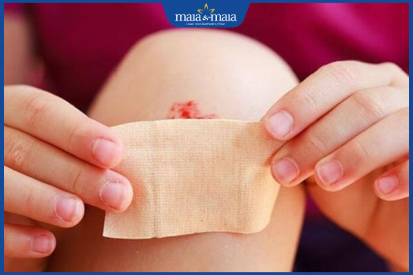 băng vết thương