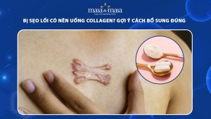 bị sẹo lồi có nên uống collagen