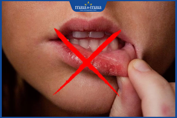 Sau phun môi bị sẹo phải làm sao? Bí kíp phòng ngừa sẹo xấu 5 bóc vảy môi