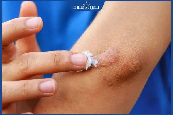 boi thuoc tri seo loi