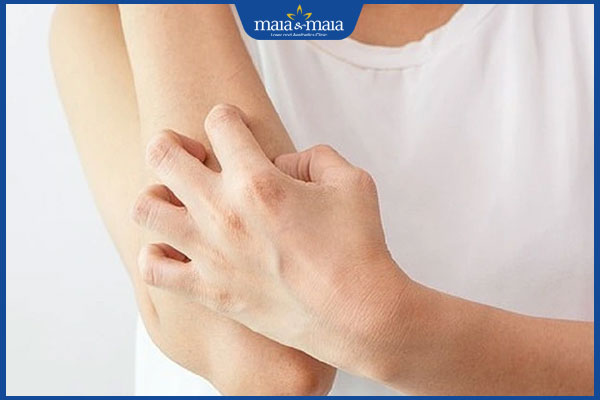 Sẹo lồi bị đau do đâu? Cách giảm đau do sẹo lồi tại nhà 2 cào gãi