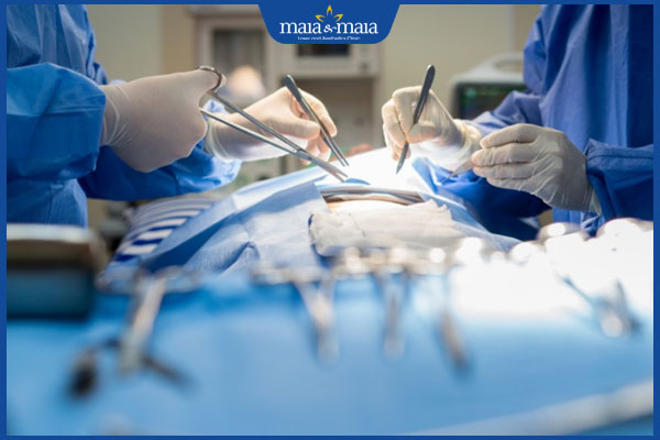 Cắt sẹo lồi giá bao nhiêu? Rủi ro khi phẫu thuật sẹo lồi giá rẻ 2 chi phí phẫu thuật sẹo lồi