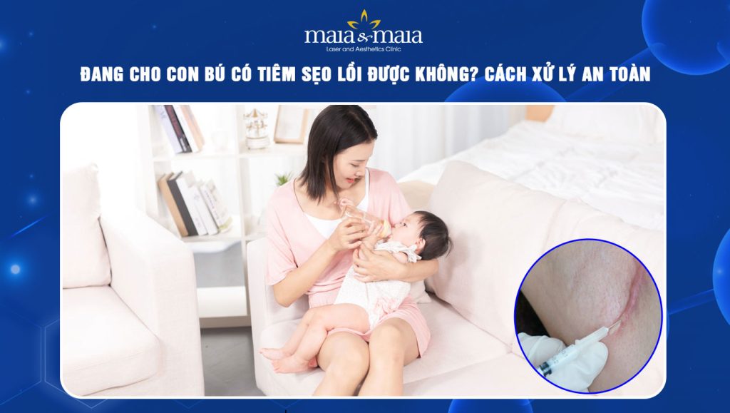 đang cho con bú có tiêm sẹo lồi được không