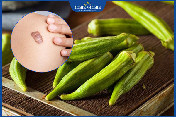 Ăn đậu bắp có bị sẹo lồi không? Thực phẩm nên kiêng tránh sẹo 2 đậu bắp