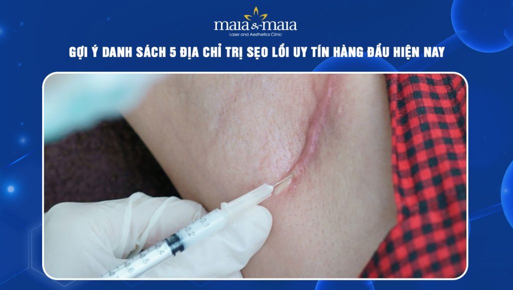 địa chỉ trị sẹo lồi