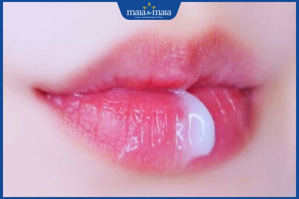 Sau phun môi bị sẹo phải làm sao? Bí kíp phòng ngừa sẹo xấu 3 dưỡng ẩm môi