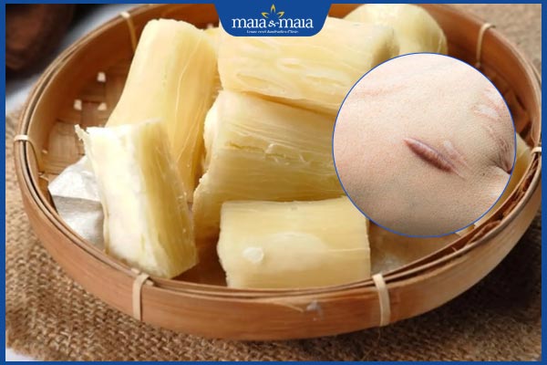 Ăn khoai mì có bị sẹo lồi không? Gợi ý thực phẩm tốt lành thương 2 khoai mì