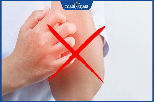 không gãi khi có vết thương