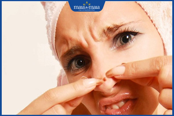 không tự nặn mụn