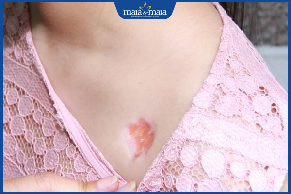 lom da do tiem seo loi