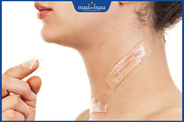 miếng dán silicon chống sẹo